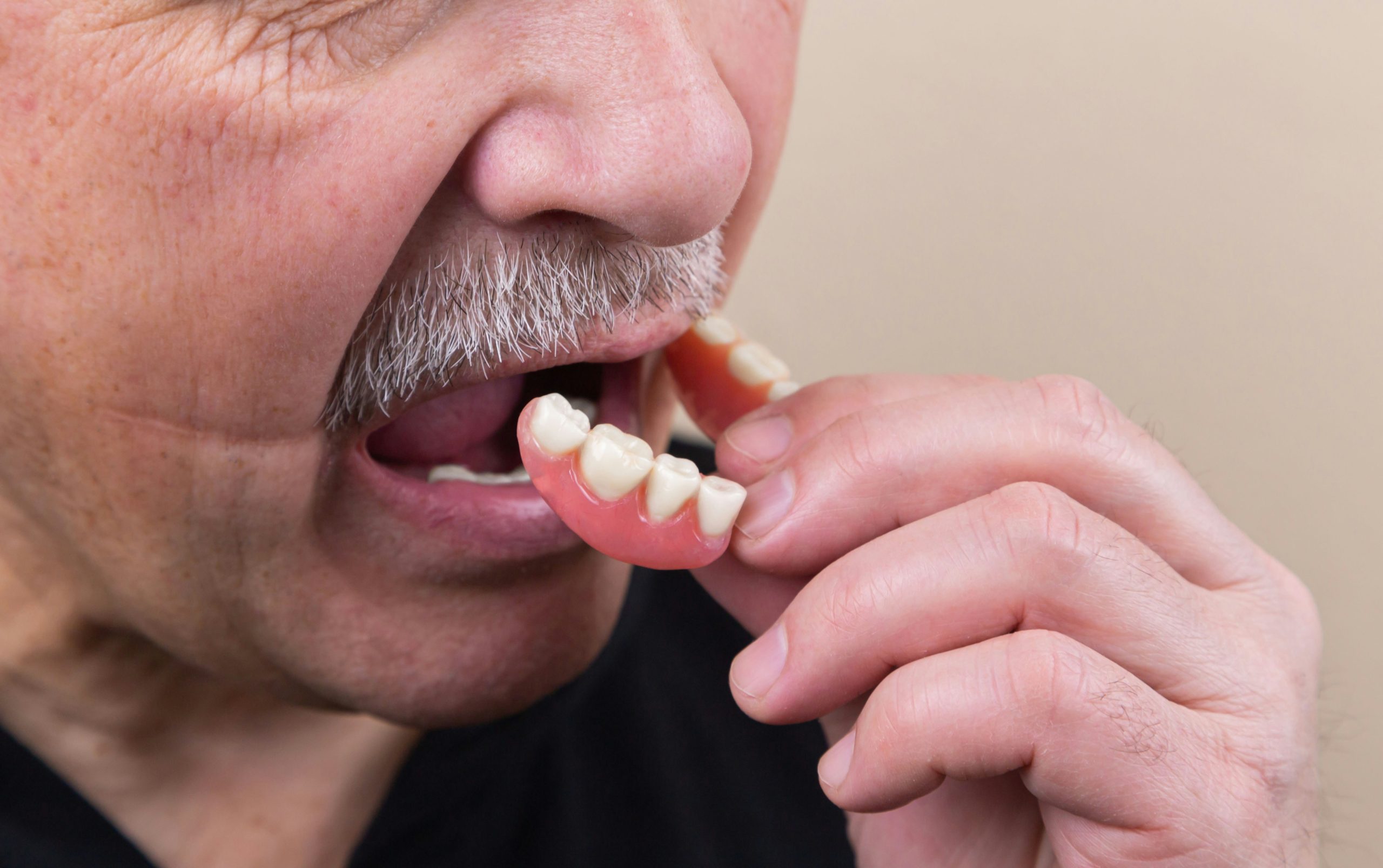 The Future of Your Smile: Exploring the Benefits of Cosmetic Dentures